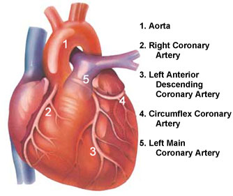 angina pectoris.jpg