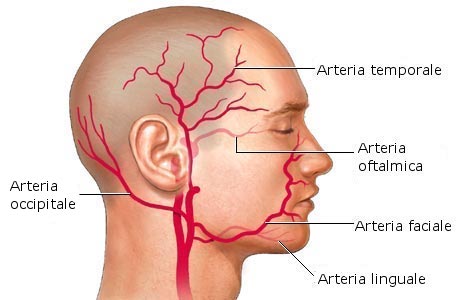 Arterite a cellule giganti : sintomi, complicazioni, cause e trattamenti