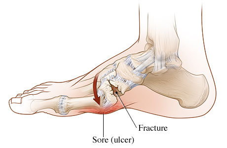 Charcot-1.jpg