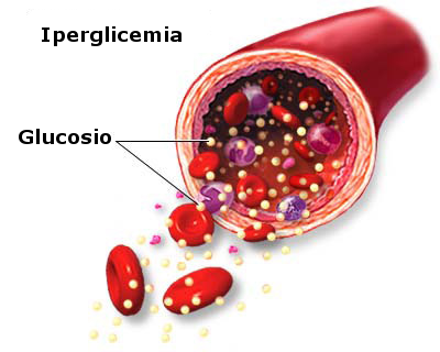 Sindrome iperosmolare diabetica : sintomi, cause, cure e prevenzione