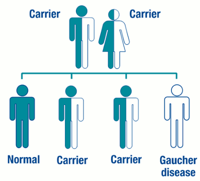 Malattia di Gaucher : sintomi, complicazioni, genetica e terapie