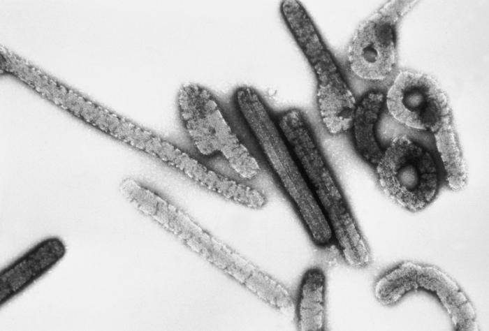 Virus Ebola e Marburg : sintomi, cause, diagnosi e prevenzione