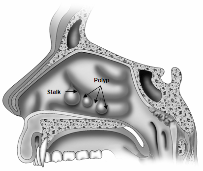 anatomia naso.gif