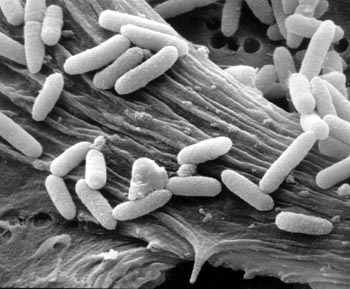 Escherichia Coli: vediamo di cosa si tratta