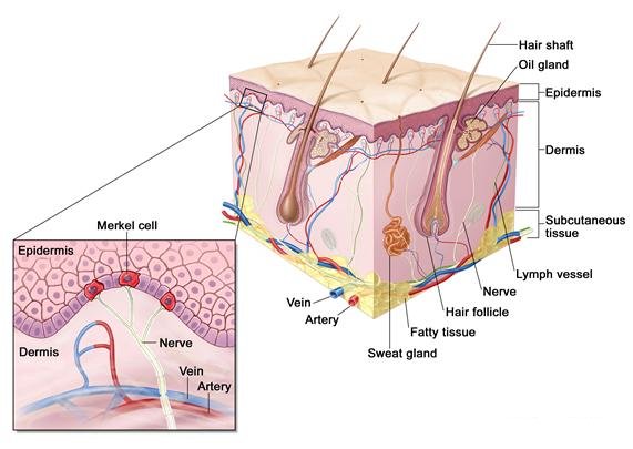 carcinoma cellule di Merkel1.jpg