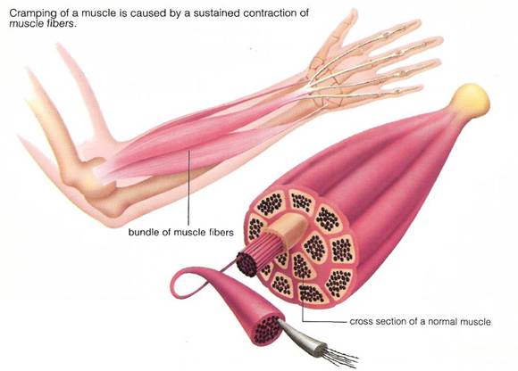 Crampi muscolari: informazioni e cause