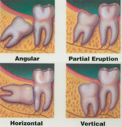 dente del giudizio.jpg