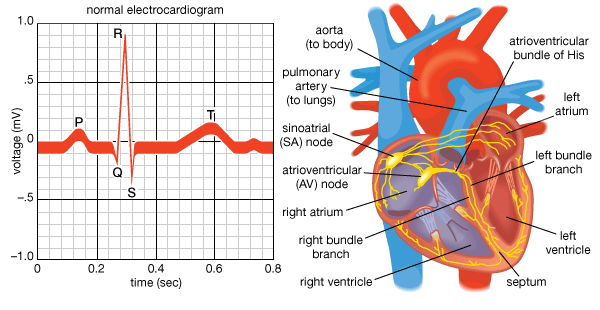 ecg1.gif