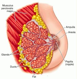 ectasia del dotto mammario1.jpg