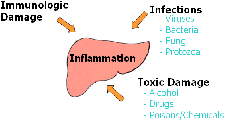 epatite tossica schema.gif