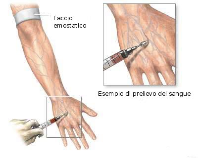 Esami del sangue per verificare il rischio di malattie cardiache