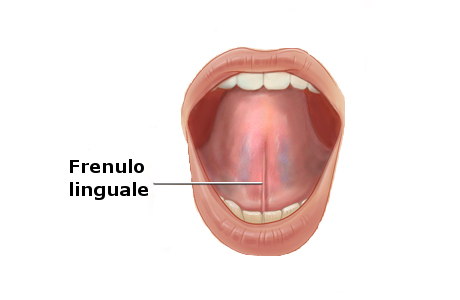 Anchiloglossia : diagnosi, cure e chirurgia