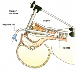 gola terapia cancro.jpg