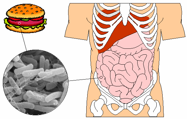 intossicazione alimentare.gif