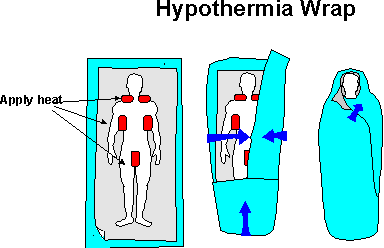 ipotermia21.gif