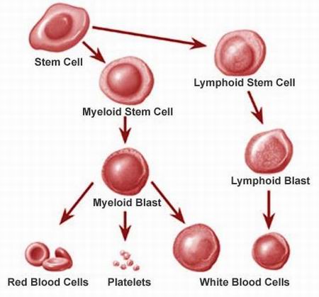 Leucemia: informazioni  e possibili terapie