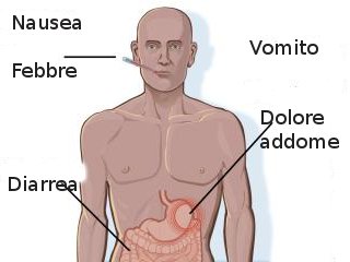 Malattie di origine alimentare: primo soccorso