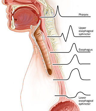 manometriaesofagea2.jpg