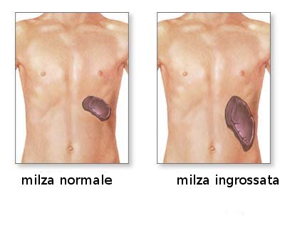 milza1.jpg