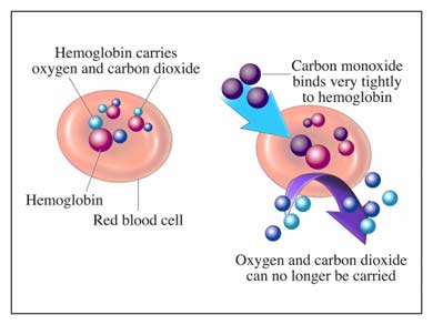 Avvelenamento da monossido di carbonio