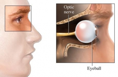 neurite ottica1.jpg