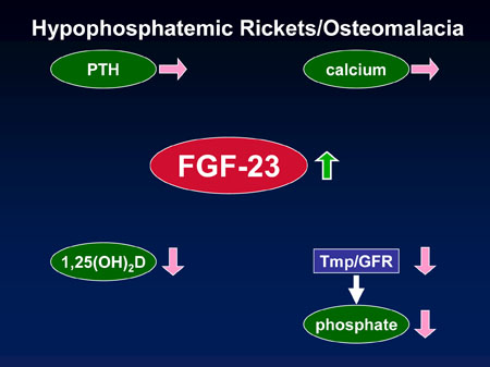 osteomalacia 21.jpg