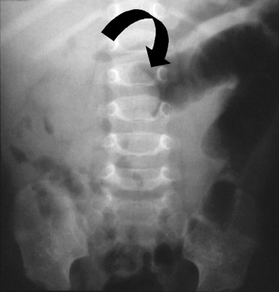 radiografia-aria1.jpg