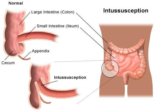 schema intestino21.gif