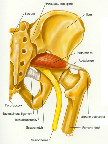 sciatica.jpg