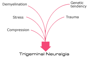 La nevralgia del trigemino:cause, sintomi, fattori scatenanti e terapie