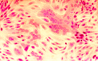 virus rsv immagine.gif