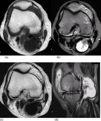 x-ray Bakers cists21.jpg