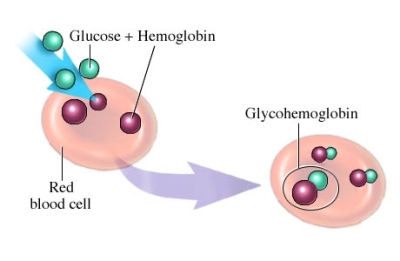 ipoglicemia