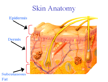 cellulite