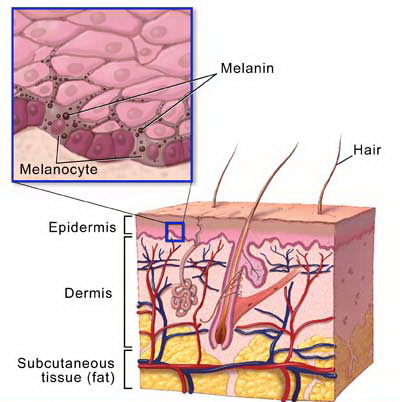 vitiligine melanociti.jpg