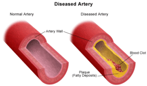 rp_arterie.gif