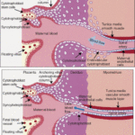 rp_preeclampsia-immagine-istologica.gif