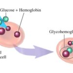 Ipoglicemia : cause e rimedi