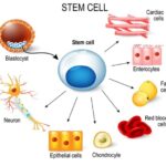Trapianto di cellule staminali