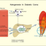 Chetoacidosi diabetica : sintomi e segni
