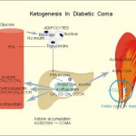 rp_ketoacidosi.jpg