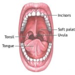 Sindrome della bocca urente