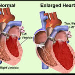 rp_cardiomegalia.jpg