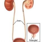 rp_ematuria1.jpeg
