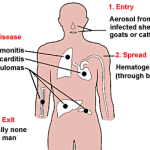 La febbre Q: sintomi, cause, rischi, diagnosi e terapie