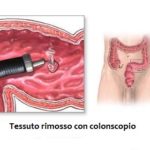 colonoscopia21