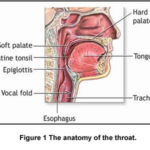 Mal di gola: segni, sintomi, cause, diagnosi e terapie