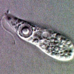 Infezione da naegleria : sintomi, cause, diagnosi e prevenzione