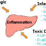 rp_epatite-tossica-schema.gif