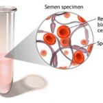 rp_emospermia-disegno-schema.jpg